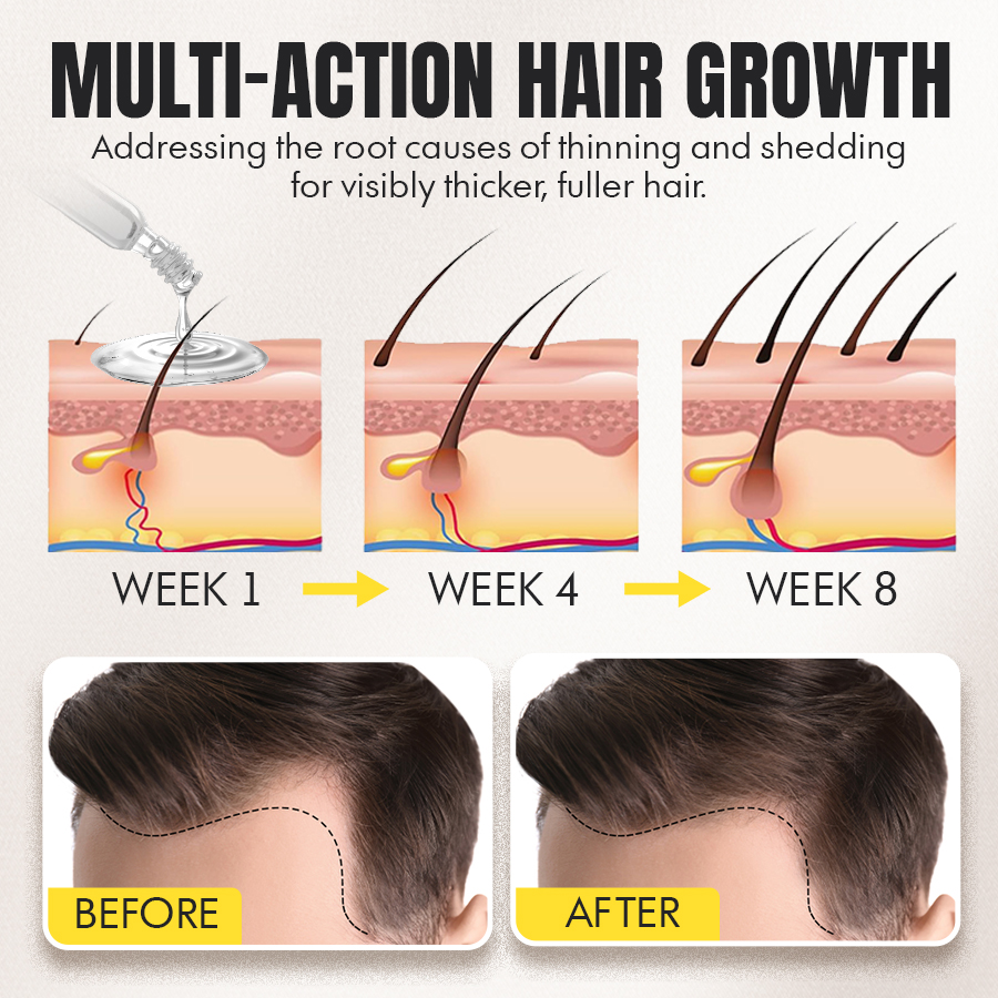 🌱Seurico™ Advanced Botanical Hair Growth & Scalp Renewal Essence