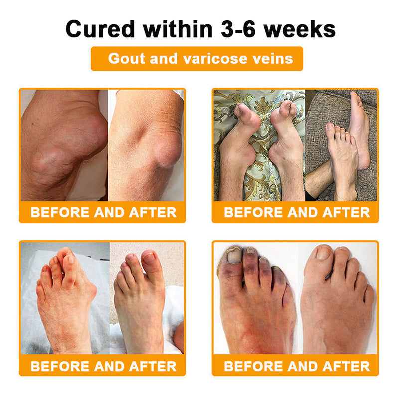 Bee Venom Joint Relief Patch 👑👑 (Specially for Older Adults)