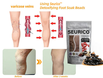 🌿Seurico™ Herbal VenoDetox Foot Bath Beads🌲(𝐋𝐀𝐍𝐀 𝐂𝐞𝐫𝐭𝐢𝐟𝐢𝐜𝐚𝐭𝐢𝐨𝐧，𝗟𝘆𝗺𝗽𝗵𝗮𝘁𝗶𝗰 𝗔𝘀𝘀𝗼𝗰𝗶𝗮𝘁𝗶𝗼𝗻 𝗼𝗳 𝗔𝗺𝗲𝗿𝗶𝗰𝗮)
