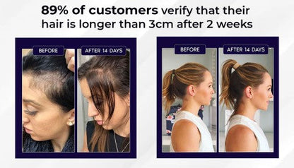 🌿 Odeiun™ Natural Hair Regrowth Spray – 70% OFF Ends Tonight! 🔥