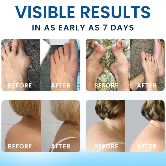 🌿FDA-APPROVED✅ Croaie® BPC-157 Joint Healing Cream - Treats Arthritis, Neuropathy, Rheumatism, Sports Injuries & More💪🏻