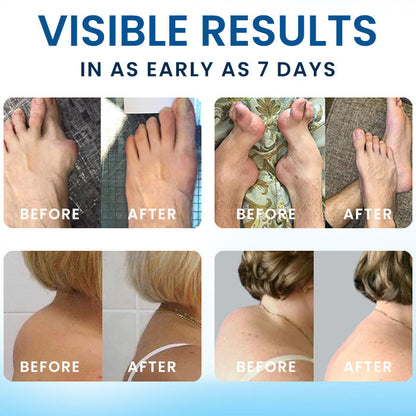 🌿FDA-APPROVED✅ Croaie® BPC-157 Joint Healing Cream - Treats Arthritis, Neuropathy, Rheumatism, Sports Injuries & More💪🏻