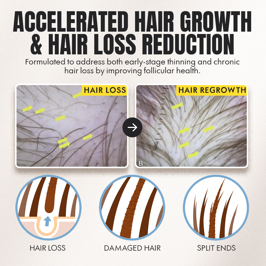 🌱Seurico™ Advanced Botanical Hair Growth & Scalp Renewal Essence