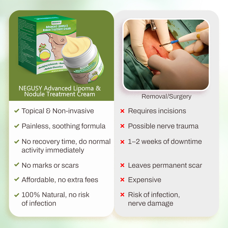 NEGUSY™Advanced Lipoma & Nodule Treatment Cream