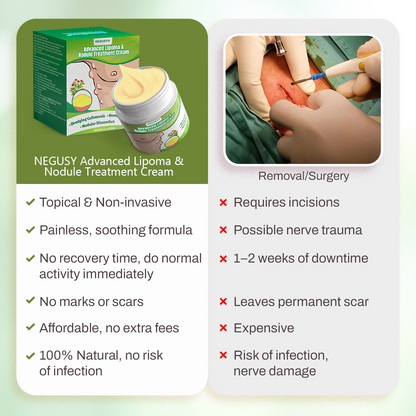 NEGUSY™Advanced Lipoma & Nodule Treatment Cream