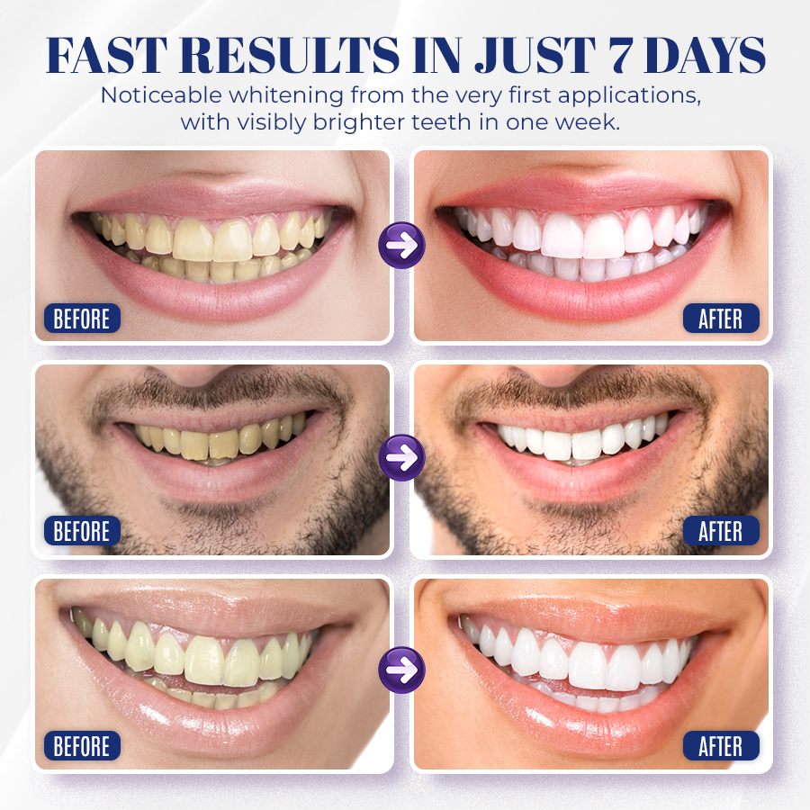🦷Bright Smile, Within Reach: Seurico™ Coconut Oil Whitening Strips