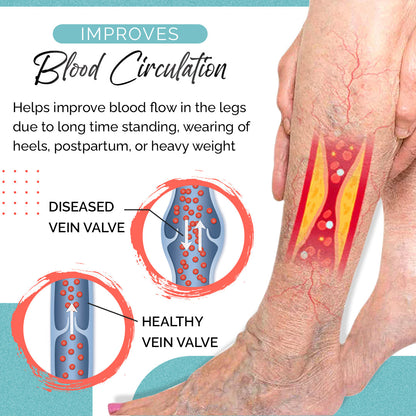 VariLuxe Varicose Veins Blue Light Treatment Pen