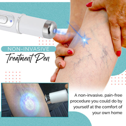 VariLuxe Varicose Veins Blue Light Treatment Pen
