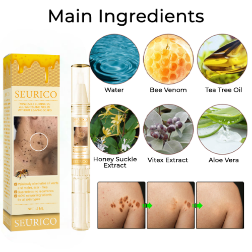 🐝Last Day Promotion 49% OFF Seurico™ Bee Venom Wart Removal Pen