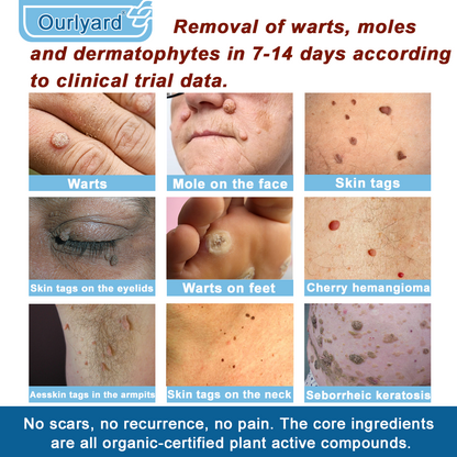 🏆✅Mayo Clinic Official: Magnesium skin repair cream (Eczema and Psoriasis Relief, Skin Repair, Even Tone, Acne and Dark Spot Treatment, Wart and Mole Removal)