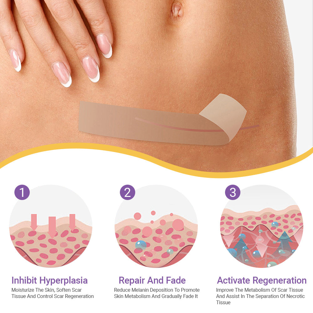 ✅Official Store |NEGUSY® Hyaluronic Acid Nano Microneedle Repair Tape🏥(Treatment of old and new scars, reduction of surgical scars, stretch marks, keloids, acne, burns, warts, dermatomes and varicose veins)