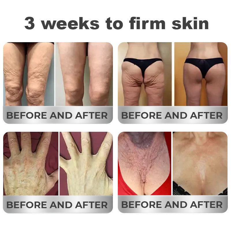 🧬𝑁𝐸𝐺𝑈𝑆𝑌® 𝑃𝑒𝑝𝑡𝑖𝑑𝑒 𝐶𝑜𝑚𝑝𝑙𝑒𝑥 𝐴𝑔𝑒-𝐷𝑒𝑓𝑦𝑖𝑛𝑔 𝑆𝑘𝑖𝑛 𝑅𝑒𝑠𝑡𝑜𝑟𝑎𝑡𝑖𝑣𝑒 𝐶𝑟𝑒𝑎𝑚