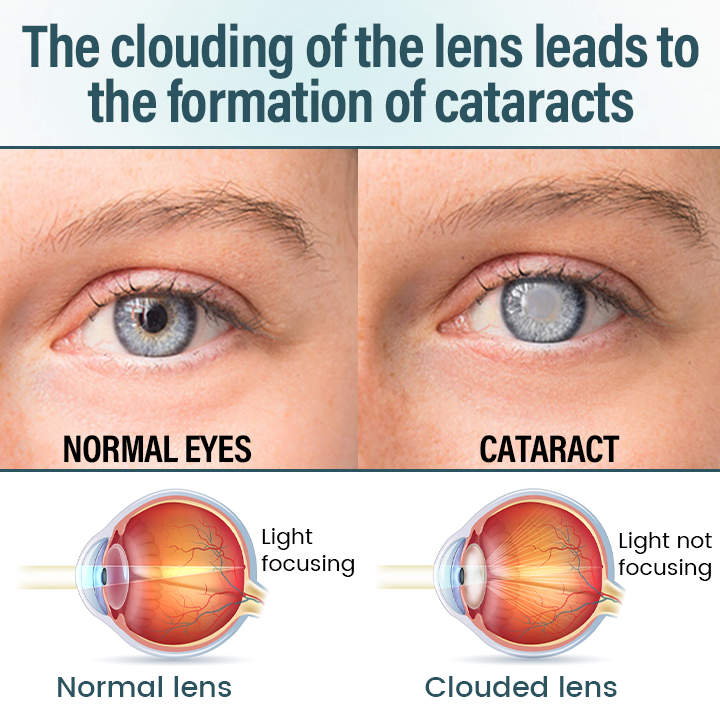 Timllk® OptiFusion Nano Eye Drops Serum