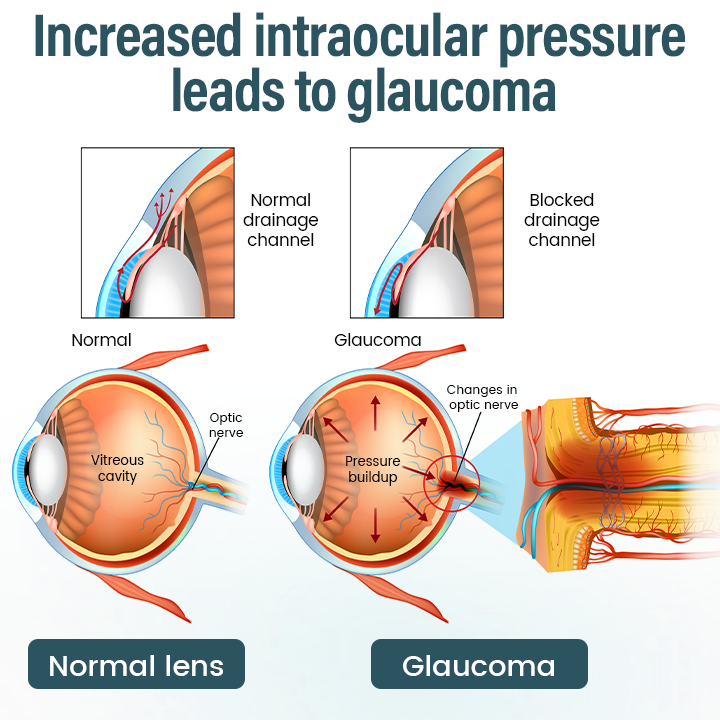 Timllk® OptiFusion Nano Eye Drops Serum