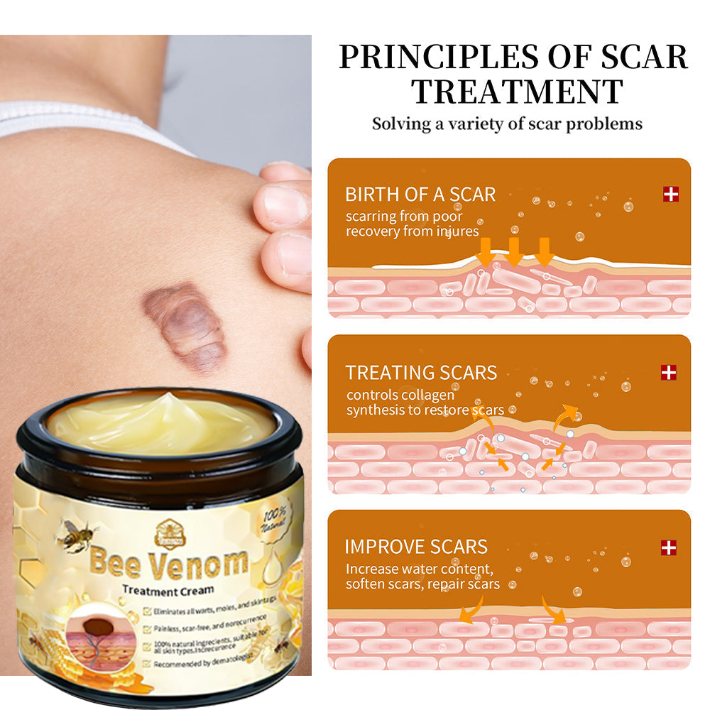 𝗧𝗟𝗢𝗣𝗔® Bee Venom Skin Treatment Cream (AAD Recommended👨‍⚕️)💖💟