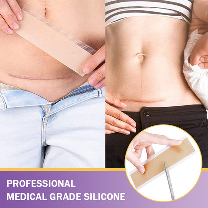 ✅Official Store |NEGUSY® Hyaluronic Acid Nano Microneedle Repair Tape🏥(Treatment of old and new scars, reduction of surgical scars, stretch marks, keloids, acne, burns, warts, dermatomes and varicose veins)