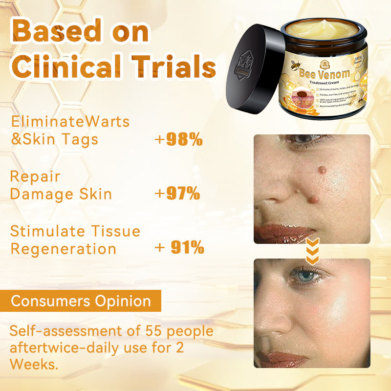 𝗧𝗟𝗢𝗣𝗔® Bee Venom Skin Treatment Cream (AAD Recommended👨‍⚕️)💖💟
