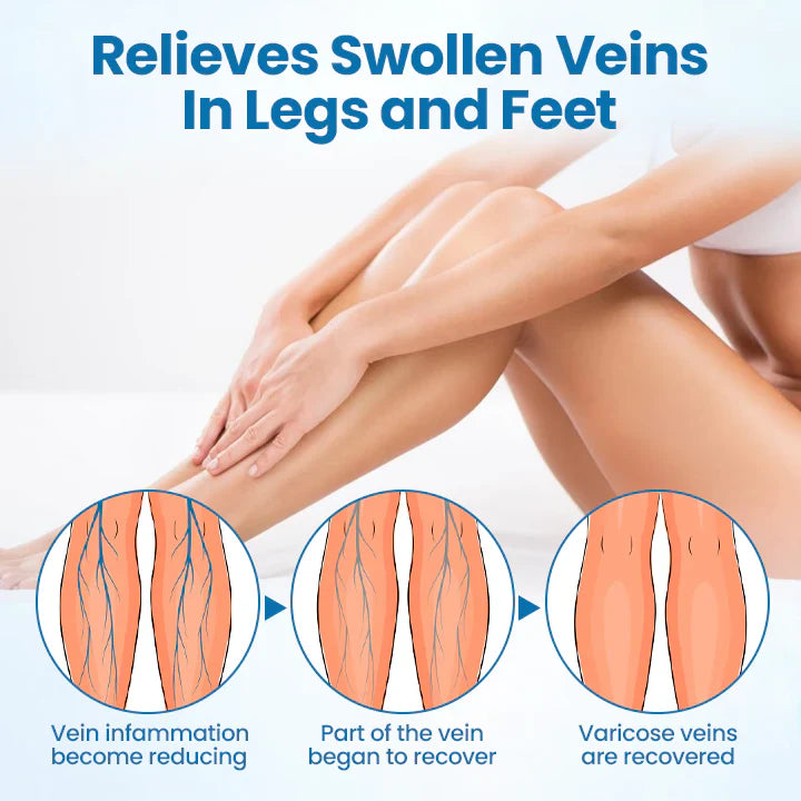 🌿NEGUSY® VeinGuard Herbal Spray-✅𝗖𝗹𝗶𝗻𝗶𝗰𝗮𝗹𝗹𝘆 𝗽𝗿𝗼𝘃𝗲𝗻 𝘁𝗼 𝗲𝗹𝗶𝗺𝗶𝗻𝗮𝘁𝗲 𝘃𝗮𝗿𝗶𝗰𝗼𝘀𝗲 𝘃𝗲𝗶𝗻𝘀 𝗶𝗻 𝗷𝘂𝘀𝘁 7 𝗱𝗮𝘆𝘀!