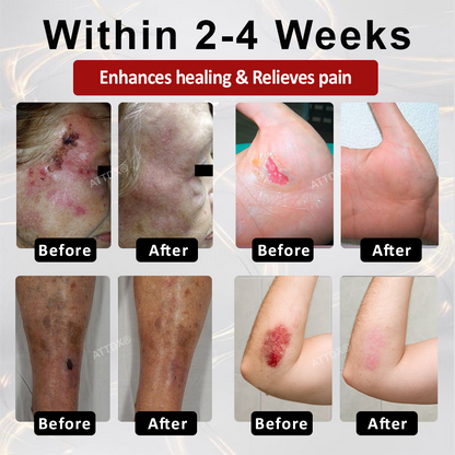 🌱 𝗡𝗘𝗚𝗨𝗦𝗬® 𝗚𝗹𝘂𝗰𝗼𝘀𝗲𝗚𝘂𝗮𝗿𝗱 𝗦𝗸𝗶𝗻 𝗥𝗲𝘀𝗰𝘂𝗲 𝗖𝗿𝗲𝗮𝗺 🌱