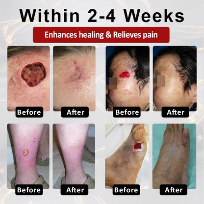 🌱 𝗡𝗘𝗚𝗨𝗦𝗬® 𝗚𝗹𝘂𝗰𝗼𝘀𝗲𝗚𝘂𝗮𝗿𝗱 𝗦𝗸𝗶𝗻 𝗥𝗲𝘀𝗰𝘂𝗲 𝗖𝗿𝗲𝗮𝗺 🌱