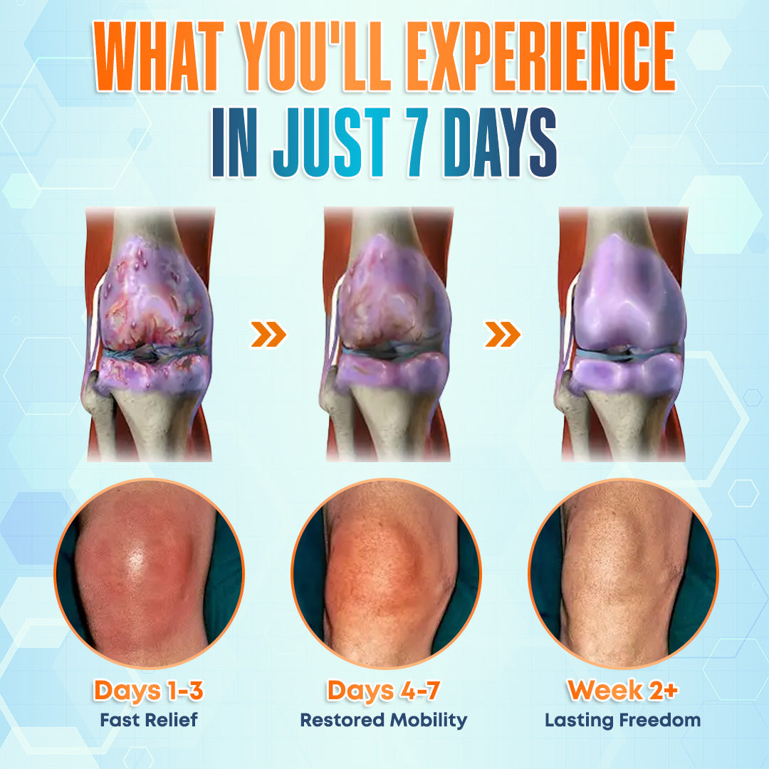 💪 Seurico™ Premium Curcumin Pain Relief Gel - Fast & Natural Relief for Joint & Muscle Pain! 🌿🔥