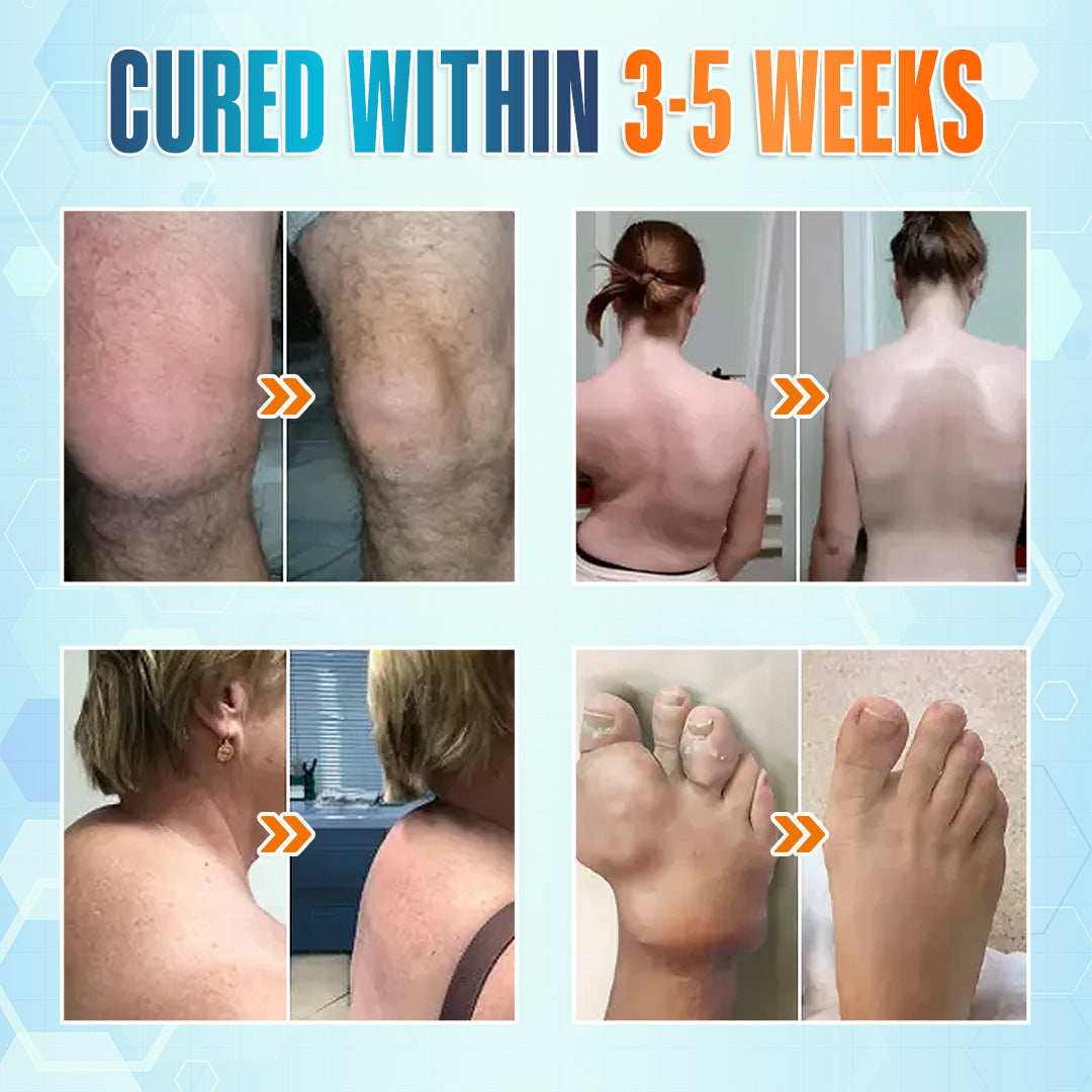 💪 Seurico™ Premium Curcumin Pain Relief Gel - Fast & Natural Relief for Joint & Muscle Pain! 🌿🔥