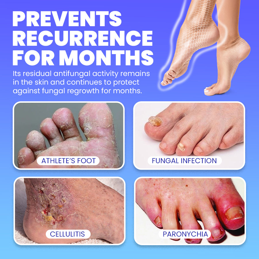 🦶Lamisill™ 1 Week Athlete's Foot Treatment, Antifungal Cream with Terbinafine Hydrochloride 1%, Fast Symptom Relief & Prevents Recurrence