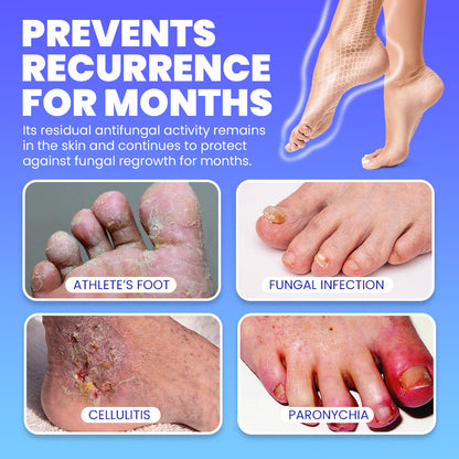 🦶Lamisill™ 1 Week Athlete's Foot Treatment, Antifungal Cream with Terbinafine Hydrochloride 1%, Fast Symptom Relief & Prevents Recurrence