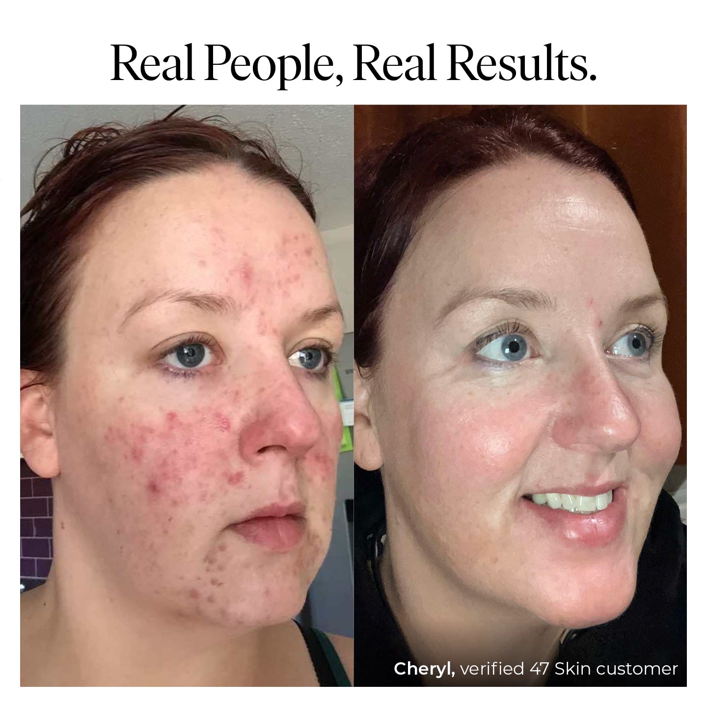 47 SKIN Aura™ Anti-Blemish & Scar Repair Serum