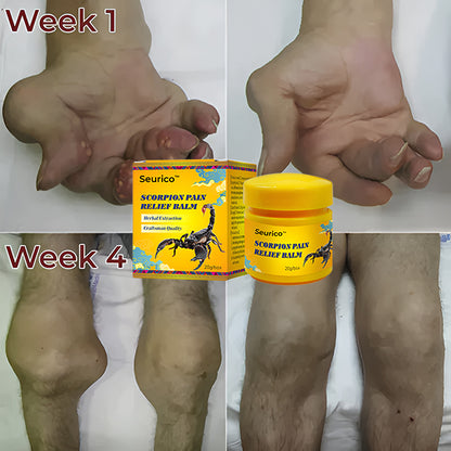 🦂 Seurico™ Schmerzlinderungscreme mit Skorpiongift