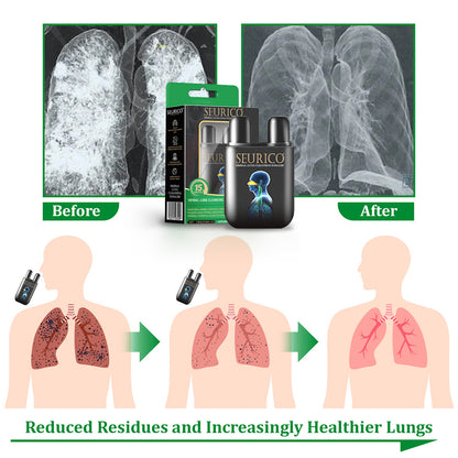 💜✅Official Store Seurico™  herbal lung cleansing inhaler 👨‍⚕️FDA Certification(💝 Cough, wheezing, shortness of breath, sputum, stuffy nose, bronchitis, bronchitis, allergy symptoms, lung discomfort💝)