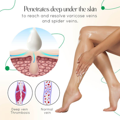 VasCulear™ Dermatologist-Recommended Vein Therapy Cream