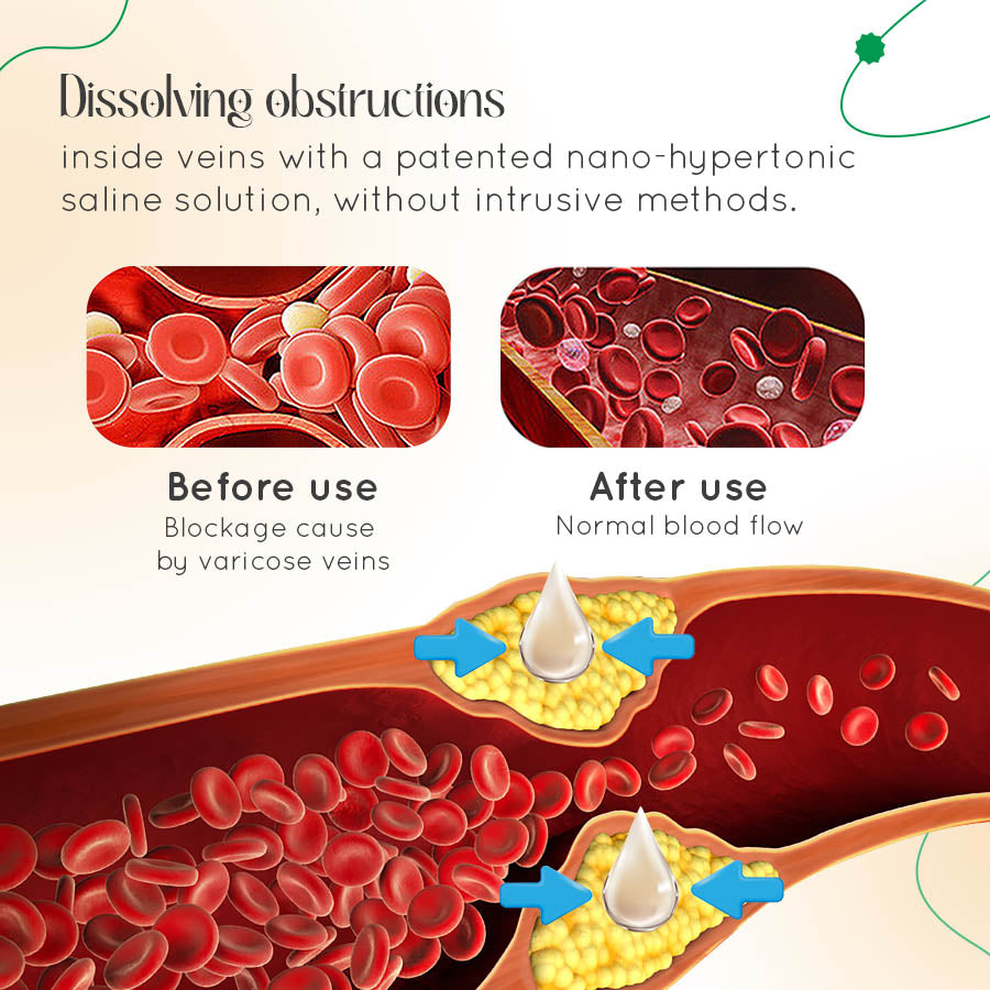 VasCulear™ Dermatologist-Recommended Vein Therapy Cream