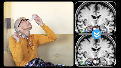 NeuroMist-Memory-Boost(treat Alzheimer's disease)