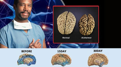 NeuroMist-Memory-Boost(treat Alzheimer's disease)