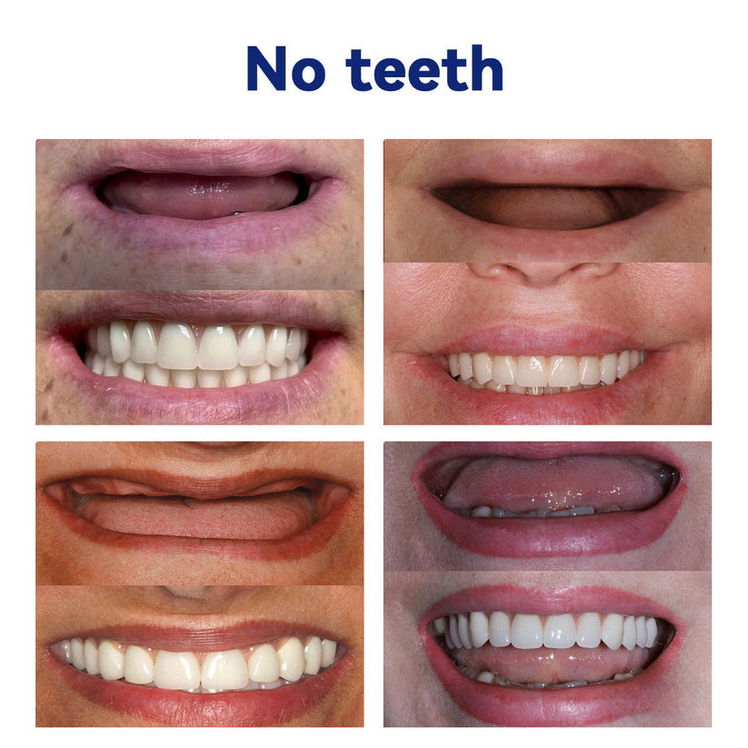 NEGUSY™ Silicone Denture Ruler Set (👩‍⚕️ADA Compliant Approved By Professional Dentists)