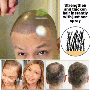 🌿 Odeiun™ Natural Hair Regrowth Spray – 70% OFF Ends Tonight! 🔥