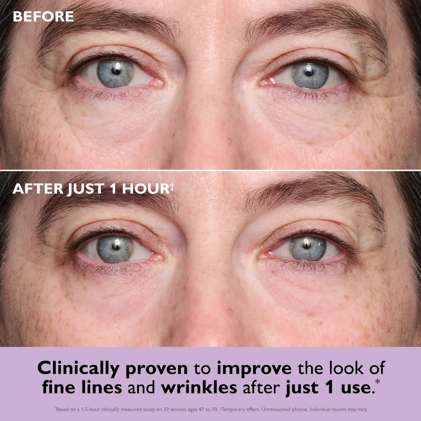 Istant Lift Eye Patches - Defy Time, Embrace Ageless Beauty