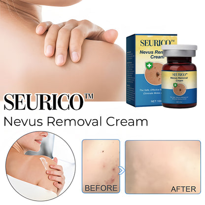 🌿 Seurico™ Nevus Removal Treatment Cream