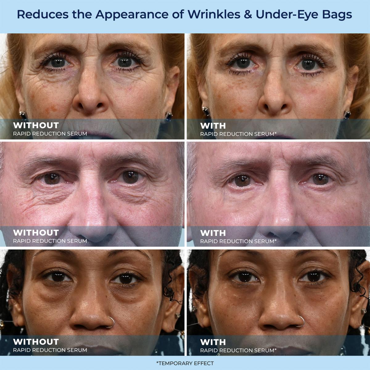 🎁Last Day Promotion 49% OFF LBMLBM™ 60-Second Anti-Aging Serum for Wrinkles, Bags & Dark Circles