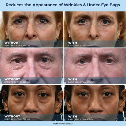 🎁Last Day Promotion 49% OFF LBMLBM™ 60-Second Anti-Aging Serum for Wrinkles, Bags & Dark Circles