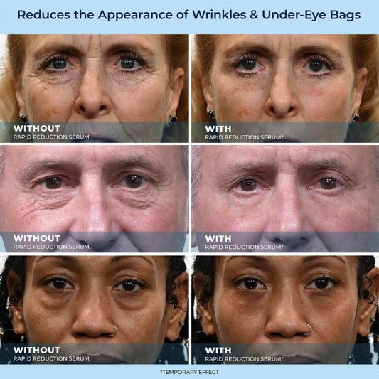 🎁Last Day Promotion 49% OFF LBMLBM™ 60-Second Anti-Aging Serum for Wrinkles, Bags & Dark Circles