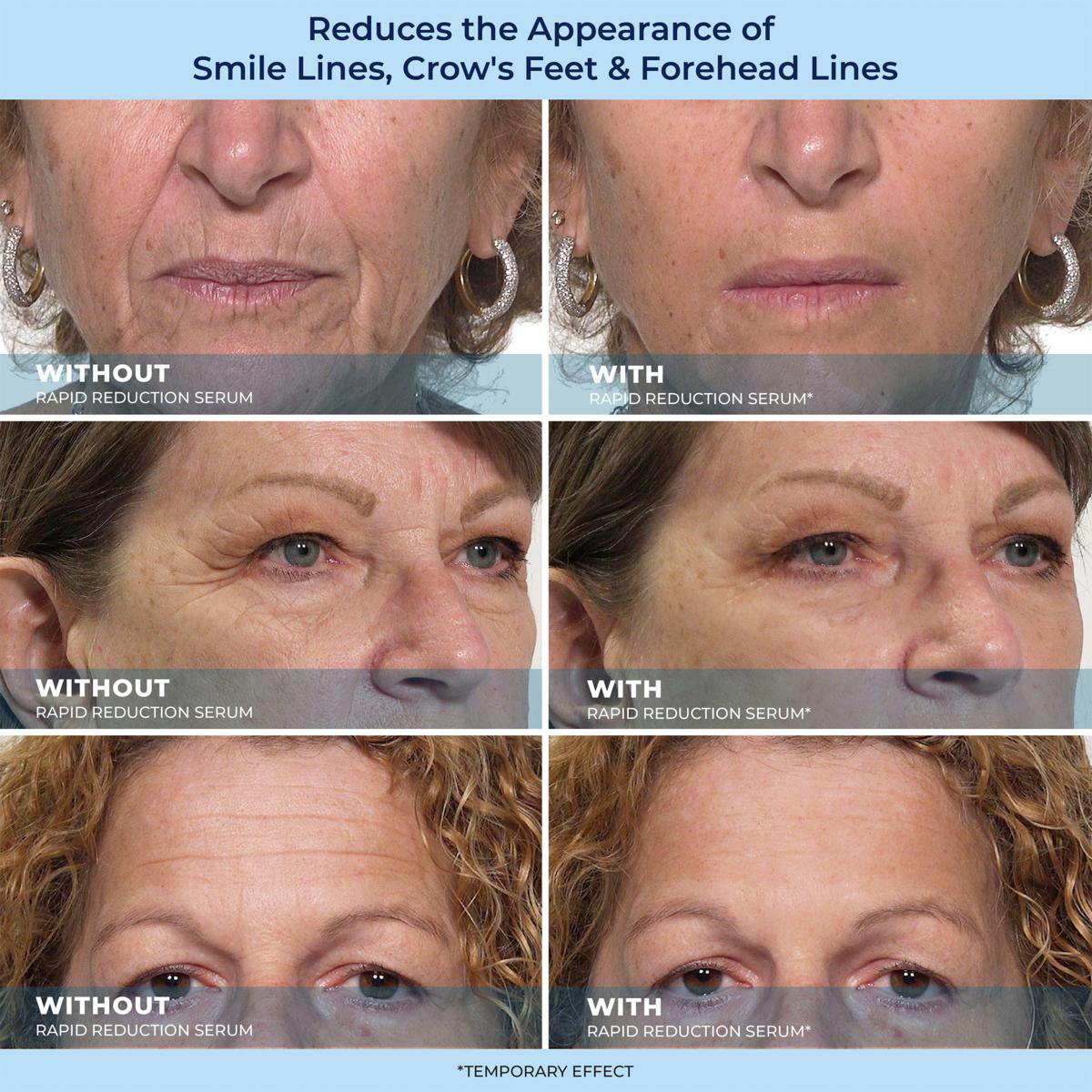 🎁Last Day Promotion 49% OFF LBMLBM™ 60-Second Anti-Aging Serum for Wrinkles, Bags & Dark Circles