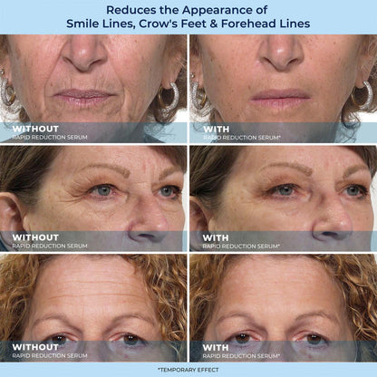 🎁Last Day Promotion 49% OFF LBMLBM™ 60-Second Anti-Aging Serum for Wrinkles, Bags & Dark Circles